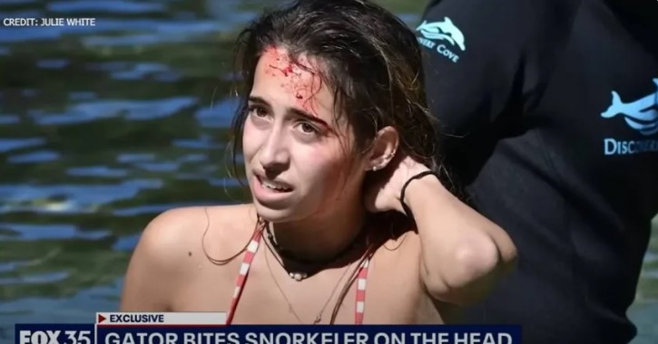 佛羅里達州浮潛女子遭3公尺長鱷魚攻擊 幸運戴全臉呼吸管免受傷