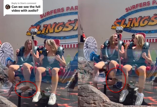 澳洲女子遊樂設施驚險經歷：腳差點被折斷